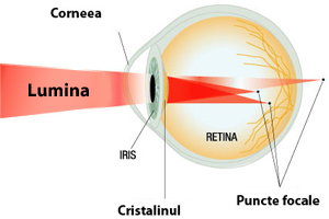 edem macular